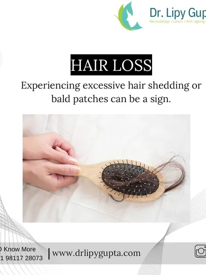 Experiencing excessive shedding on your hairbrush or in the shower is another major indicator. While some daily hair fall is normal, finding clumps of hair or noticeable bald patches is a sign that you need a professional consultation.