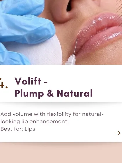 This graphic explains Juvederm Volift, a filler I often use for lips. It's designed to add volume with flexibility, which is key for achieving a natural-looking enhancement.