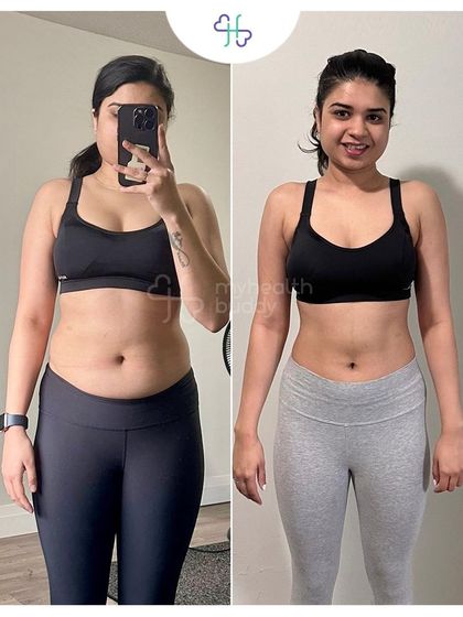 From 56 kg to 51 kg in 6 months. This client focused first on losing stubborn belly fat with home-cooked food, then on gaining muscle with heavy weightlifting.