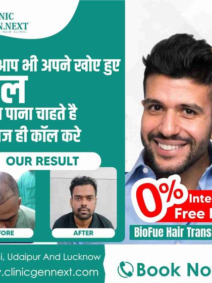 Want your hair back? Call today to learn about my 0% interest-free EMI options for Bio-FUE hair transplants. The package includes free PRP, tests, and more.