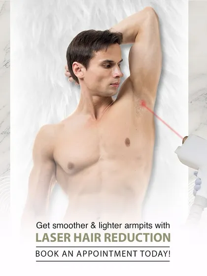Laser hair reduction is a popular and effective treatment for men, too. Here we are targeting the underarm area for a clean, smooth result.