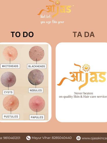 From whiteheads and blackheads to more severe cysts and nodules, we have a solution for every type of acne. Our quality skin and hair care services are designed to tackle your concerns and deliver results.