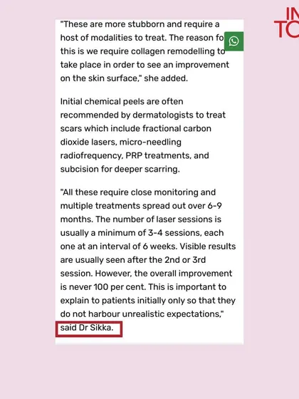 In the India Today article, I explained that treating stubborn acne scars requires multiple sessions of advanced treatments like lasers and microneedling over several months, and it is important to have realistic expectations about the results.