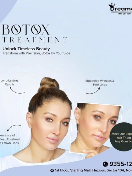 A before-and-after look at the effects of Botox, showing how it smooths wrinkles and fine lines like crow's feet and frown lines for long-lasting, beautiful results.