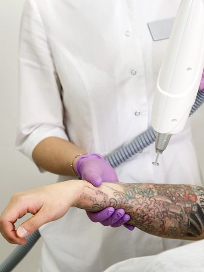 This patient is undergoing removal of a large, multi-colored tattoo on their arm. My advanced lasers can target different ink colors, although some may require more sessions than others. I create a realistic treatment plan during the initial consultation.