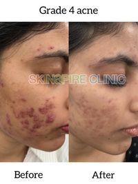 Medical-Grade Facials & Peels