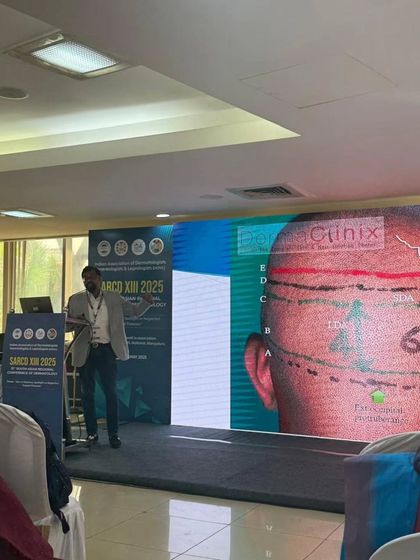 On stage at SARCD 2025, presenting a detailed diagram on hairline design and donor area planning. A natural-looking result starts with meticulous planning.