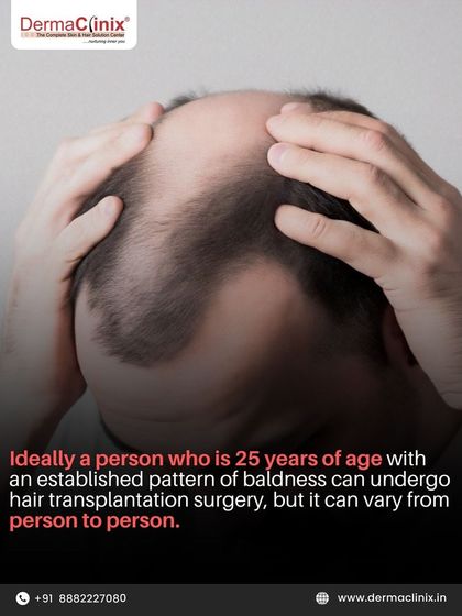 Ideally, a person who is 25 years of age with an established pattern of baldness can undergo surgery. However, this can vary from person to person, and a personal consultation is always necessary.
