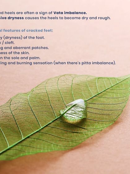 Cracked heels are often a sign of a Vata dosha imbalance, leading to excessive dryness. The clinical features can include aridity, cracks, itching, and sometimes pain or a burning sensation.