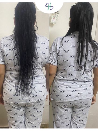 Back view of Vidhi's progress.