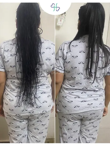 Vidhi's back progress, showing a stronger and more toned physique. Her journey is about more than just weight loss; it's about improved health.