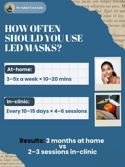 How often should you use LED masks? For at-home devices, I suggest 3 to 5 times a week. For powerful in-clinic treatments, a session every 10 to 15 days for a series of 4 to 6 sessions will yield much faster and more significant results.