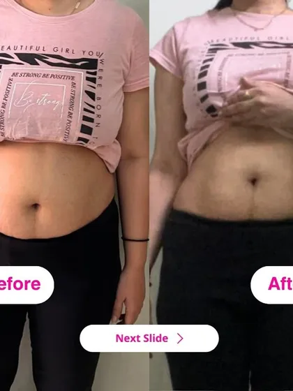 Here is a front view of a client's transformation. She lost 7 kgs, reduced belly fat, and increased her muscle mass, all while eating nourishing meals and following a sustainable plan.