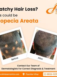 Hair Restoration & Loss Treatment