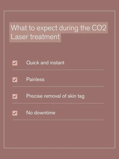What can you expect during a CO2 laser treatment for skin tags? The procedure is quick, painless, precise, and involves no downtime, so you can get back to your routine immediately.