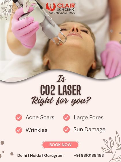 Is CO2 Laser right for you? This powerful resurfacing treatment is one of our most effective solutions for stubborn concerns like deep acne scars, wrinkles, large pores, and significant sun damage, delivering dramatic skin rejuvenation.