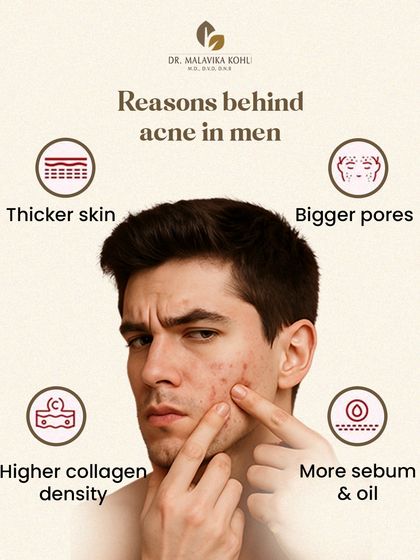 Men's skin has distinct biological characteristics that influence acne presentation. It is approximately 25% thicker, has larger pores, and produces more sebum, all of which can contribute to a higher likelihood of breakouts. Treatment must be adapted to these factors.