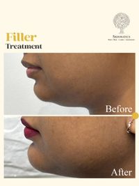 Facial Aesthetics & Anti-Aging