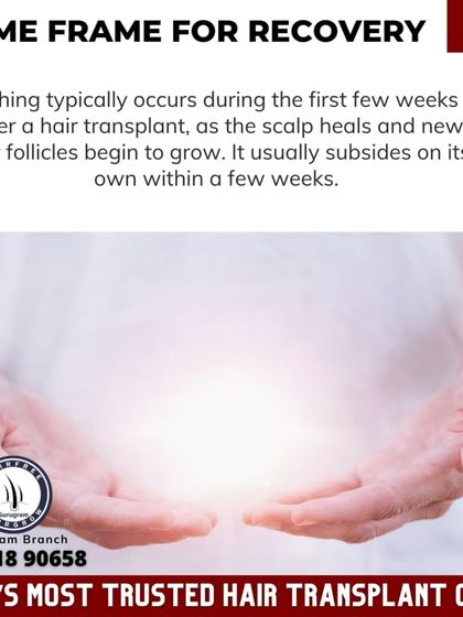 This graphic explains the recovery timeframe, noting that itching typically occurs in the first few weeks and subsides on its own as the scalp heals.