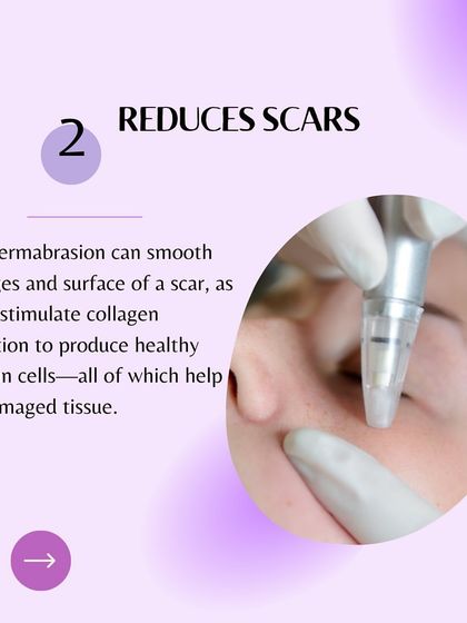 Clinic Next Face - Advanced Skin Treatments Skin Resurfacing & Repair photo 17