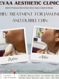 Skin Tightening & Non-Surgical Lifts