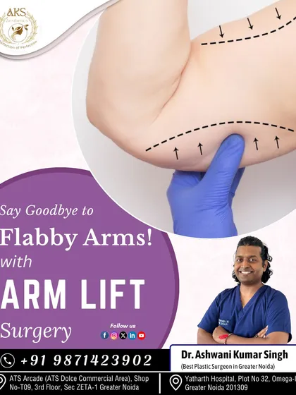 An arm lift, or brachioplasty, is designed to address loose, sagging skin on the upper arms. This procedure removes the excess skin and fat, resulting in a more toned and youthful arm contour, allowing you to feel confident in any attire.