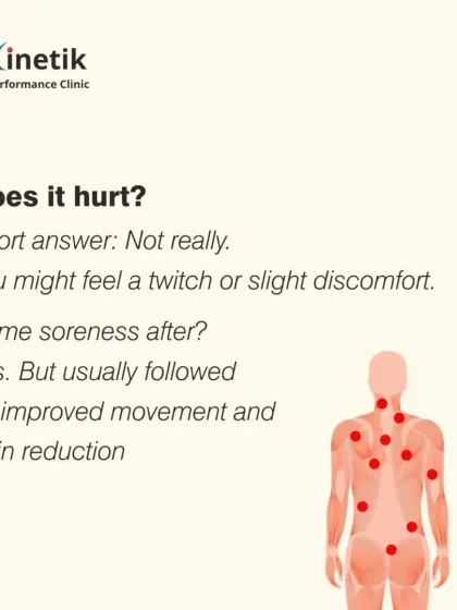 Does dry needling hurt? Not really. You might feel a brief muscle twitch or slight discomfort as the trigger point releases. Some soreness afterward is normal, but it is usually followed by improved movement and significant pain reduction.