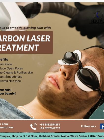 Say hello to smooth, glowing skin with our Carbon Laser Treatment. This graphic explains how the treatment provides an instant glow, reduces open pores, and purifies the skin for a smoother feel and improved tone.