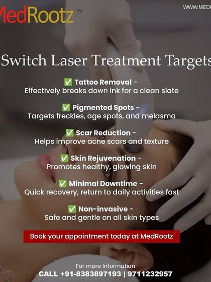 This graphic explains what the Q-Switch laser targets. It's a versatile tool I use for everything from tattoo removal and pigmented spots like freckles to reducing the appearance of acne scars.