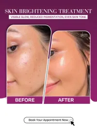 Advanced Medical Facials