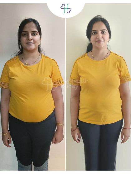 Yashika lost 4 kgs in 12 weeks, starting just 2 months after her C-section. Even with an irregular routine, focusing on protein and steps made a huge difference.
