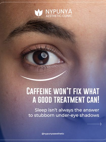 Caffeine won't fix what a good treatment can. Stubborn under-eye shadows often have causes beyond just lack of sleep.