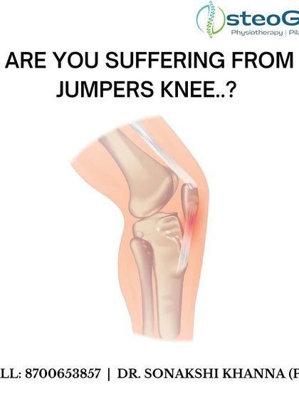Jumper's Knee is an overuse injury affecting the tendon connecting the kneecap to the shinbone, common in sports with a lot of running and jumping. This graphic illustrates the affected area.