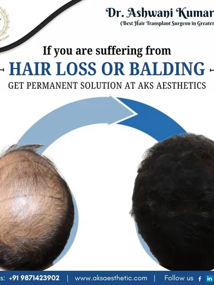 (Hero Media) This visual represents the core of my work: providing a permanent, natural-looking solution to hair loss. My goal is to restore not just your hair, but also your confidence, using safe and advanced hair transplant techniques.