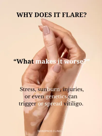 Certain factors can trigger or worsen vitiligo. Stress, sunburn, skin injuries, and genetics can all play a role in its flare-ups, making a holistic management approach crucial.