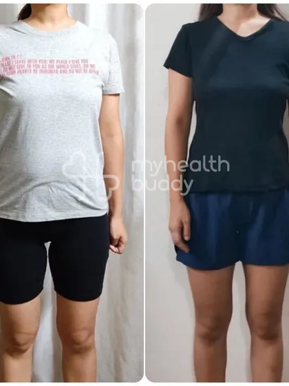 A full-body view of a client's Diastasis Recti correction and weight loss journey. She achieved a flatter stomach and a stronger core.