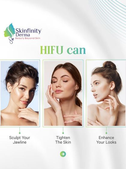 HIFU can do more than just address a double chin. It helps sculpt your jawline, tighten the skin, and enhance your overall look for a firmer, more youthful appearance.