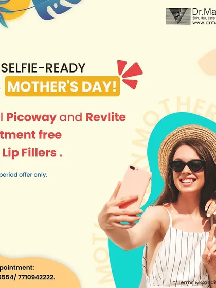 This Mother's Day, we offered a special package to help moms feel their best. This promotion combined Lip Fillers with complimentary Picoway and Revlite laser treatments, perfect for achieving a refreshed, selfie-ready glow.