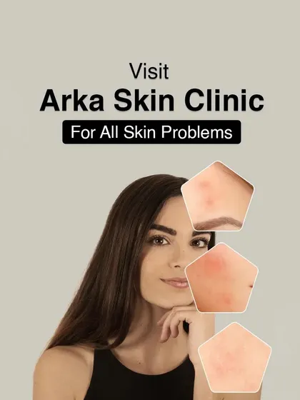 For all skin problems, from acne to aging, a visit to Arka Skin Clinic is the first step towards a solution. We are here to address all your concerns under one roof.