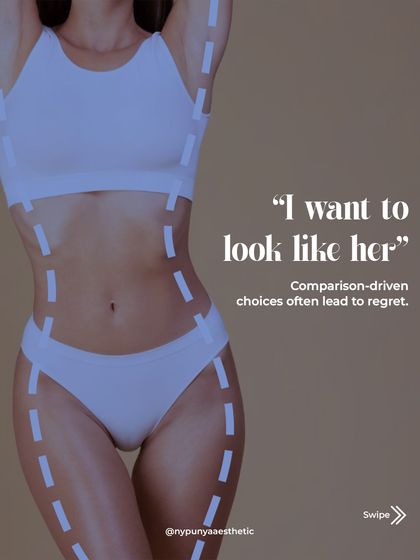 Wanting to look like someone else often leads to dissatisfaction. Our goal is to enhance your unique anatomy, not replicate another person's, ensuring the results are truly yours.