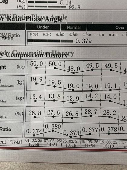 This chart tracks the progress of a 32-year-old patient who combined our Mounjaro program with Wonder Prestige body contouring. The results show a significant drop in body fat percentage and an increase in skeletal muscle mass, breaking through her previous weight loss plateau.