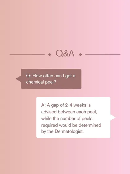 "How often can I get a chemical peel?" I generally advise a gap of 2 to 4 weeks between sessions, but the exact number and frequency will be determined during your personal consultation.