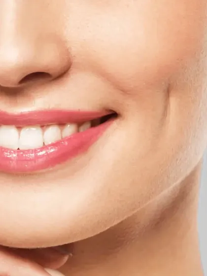 A simple dimple can completely transform a smile. Dimple creation is a quick and straightforward procedure that I perform to add a touch of charm and character to the face, resulting in a natural and attractive look.