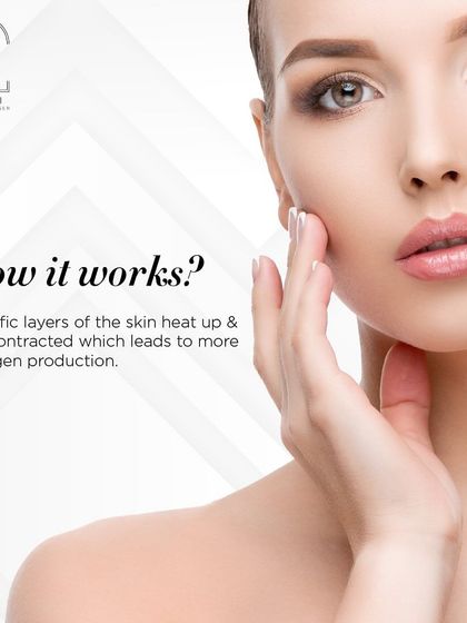 An insight into how HIFU works: specific layers of the skin heat up and contract, which leads to more collagen production.