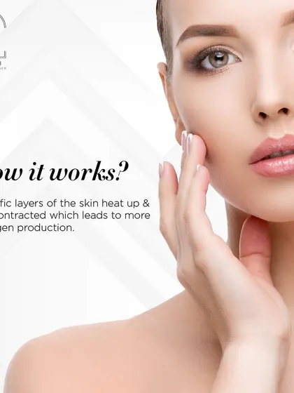 Wondering how HIFU works? It functions by gently heating specific layers of the skin. This controlled thermal effect causes the tissues to contract and stimulates a powerful collagen production response for firmer skin.
