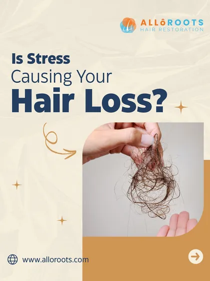 Is stress causing your hair loss? Finding clumps of hair can be alarming, and chronic stress is a well-known contributor. It disrupts the hair growth cycle, leading to increased shedding over time.
