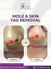 Skin Rejuvenation & Brightening