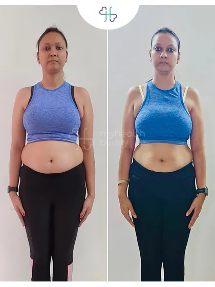 A 3 kg weight loss over 6 months, but a huge gain in strength and confidence. This client learned to push beyond her limits safely, celebrating every small victory along the way.