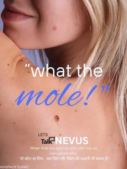 Every mole, or nevus, tells a part of your skin's story. I can help you understand that story, determine if a mole is safe, or remove it for cosmetic or medical peace of mind.