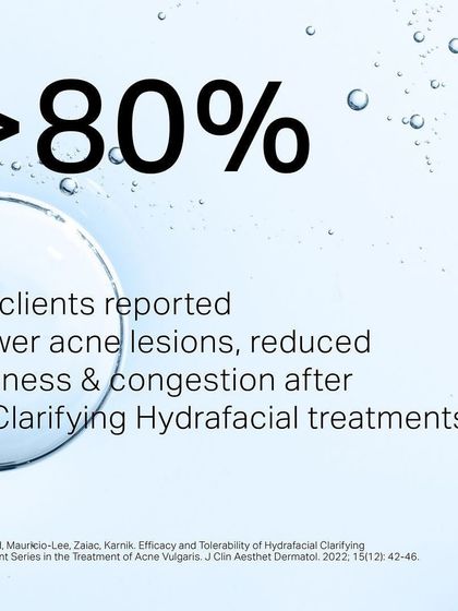 Clinical data shows that over 80% of clients reported fewer acne lesions and reduced oiliness after a series of Clarifying HydraFacial treatments.